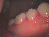 ���F���ꂽ��1