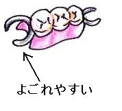 デンチャープラーク2