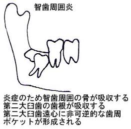 ����P���̎������z������