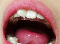 ��{�^�X�v�����g�@