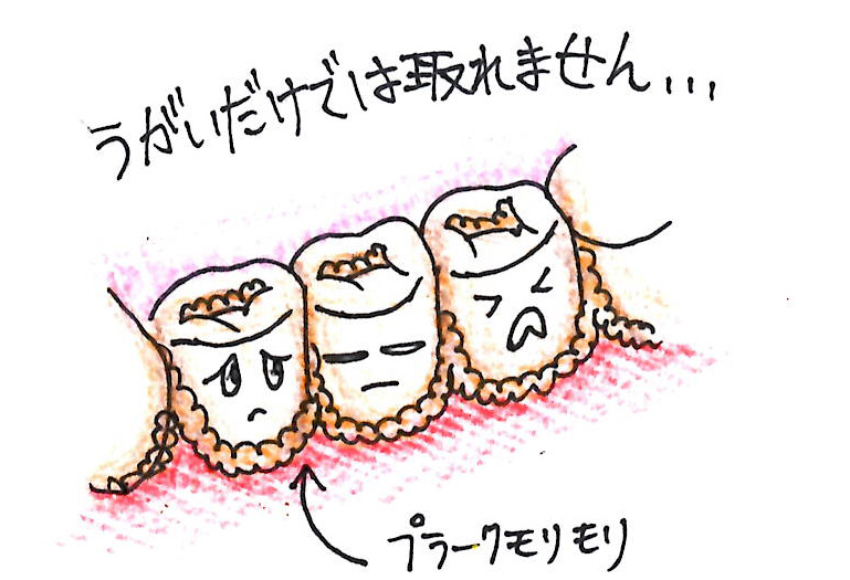 歯垢とは