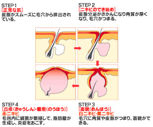 �j�L�r�̂ł��郁�J�j�Y��